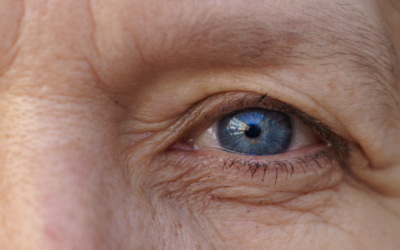 Busting Myths About Cataract Surgery