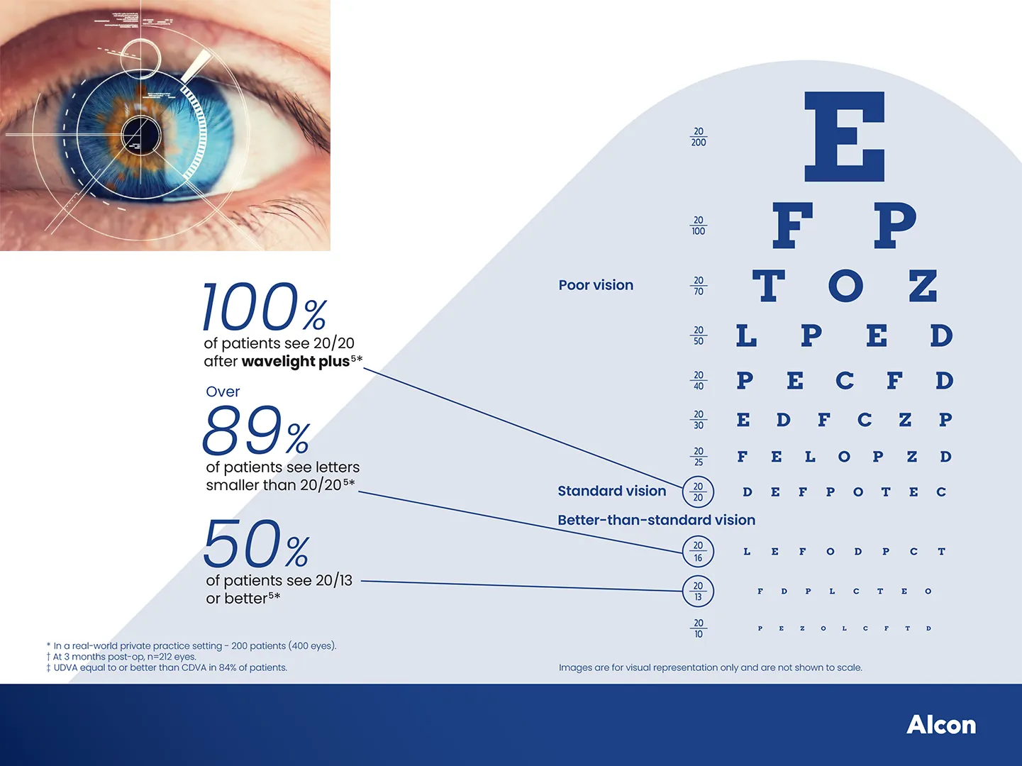 Wavelight Plus | Go Beyond 20/20 Vision