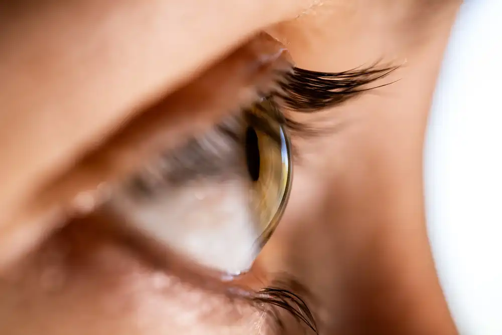 What Does It Mean to Have a Thin Cornea?