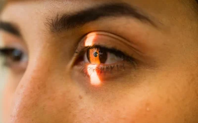 What Happens During A Comprehensive LASIK Evaluation?