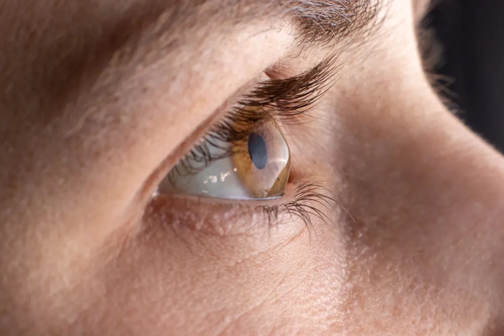 Corneal measurements