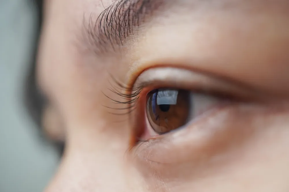Why Corneal Measurements Are Critical